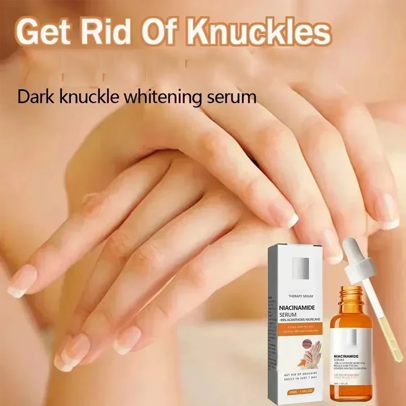 Dark Knuckles Whitening Serum Elbows Armpit Beaching Serum Woman Skin Removal Dark Knuckles skin whitening serum