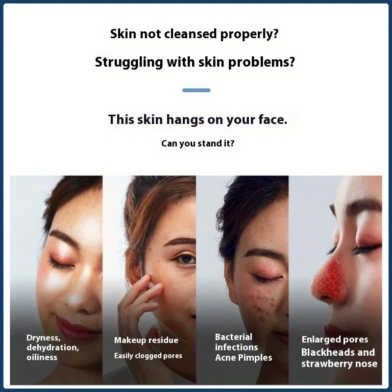 Electric blackhead sucker pore cleaner face cleansing beauty instrument acne pores acne facial skin care beauty tools