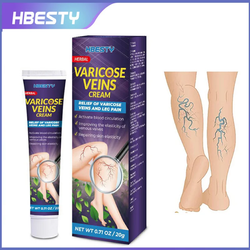 

Эффективный крем от варикозного расширения вен HBESTY, мазь для васкулита, флебита, Успокаивающий Крем для ног