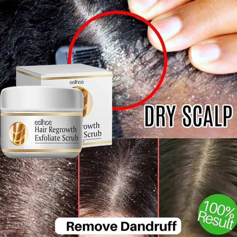 

Fast Anti Dandruff Hair Treatment Scrub Itching Repair Scalp Cleaning Exfoliating Products Oil Control Antipruritic Hair Care