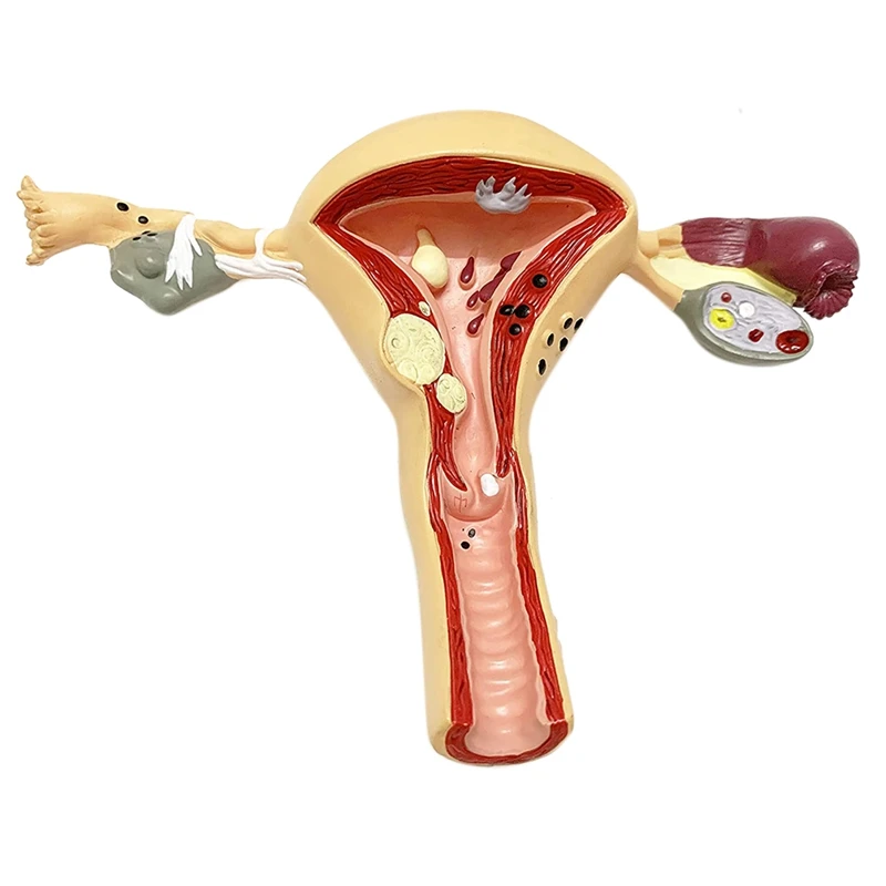

Человеческая матка и искусство, модель женского репродуктивного органа, женский половой орган, обучение анатомии медицины
