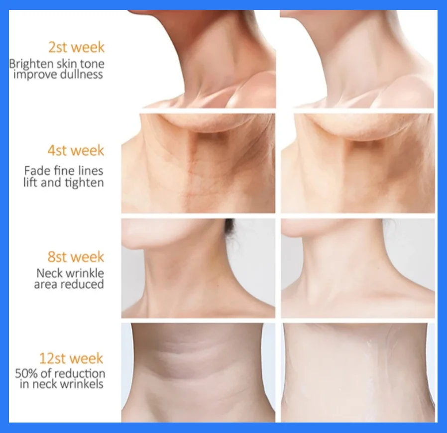 Neck Cream Collagen Eliminate Neck Wrinkle Lines Lifting Whitening Tighten Double Chin Anti-age Rejuvenation Skin Care Product