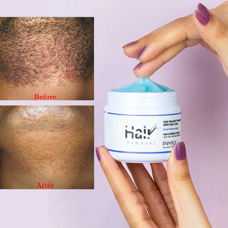 Permanant Hair Growth Removal Inhibitor Beard Bikini Intimate Legs Body