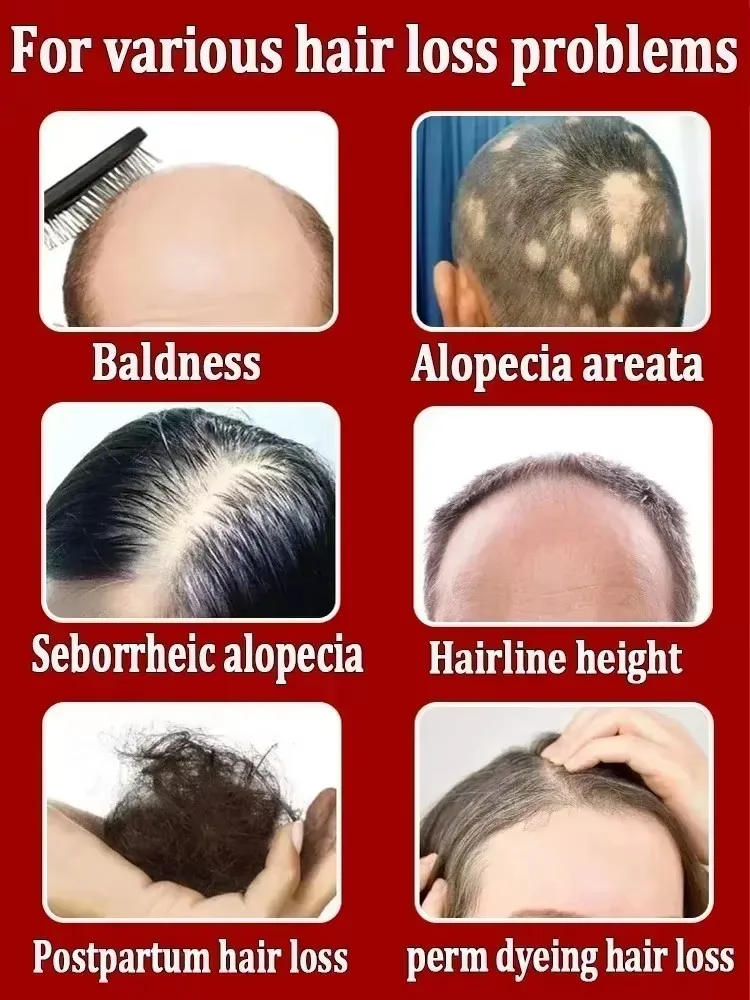 Hair Growth Oil Have More And More Hair Say Goodbye To Baldness Thick Hair