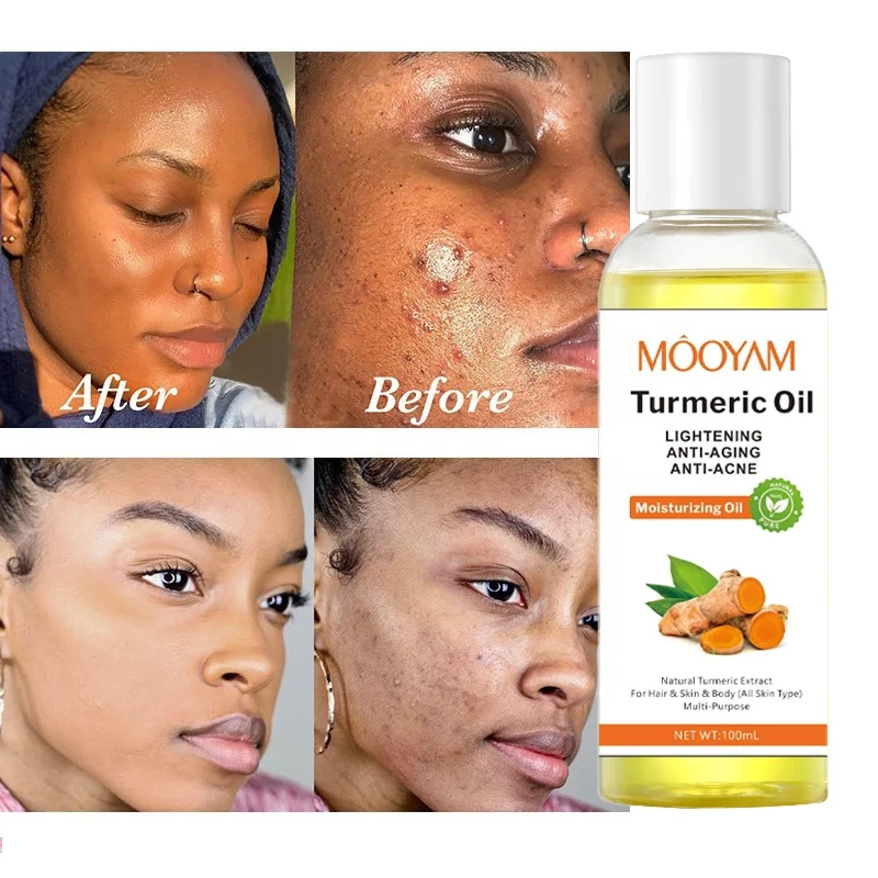 

100ml Turmeric Face Serum Whitening Dark Spot Remover Acne Scar Bright Skin Anti Aging Face Oil Brighten Improve Roughness Skin