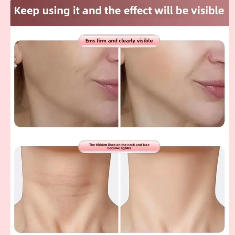 EMS Roller Face-Slimming Artifact V-Face Beauty Facial Massager For Firming And Lifting The Face 5 EMS Roller Face-Slimming Artifact V-Face Beauty Facial Massager For Firming And Lifting The Face 5