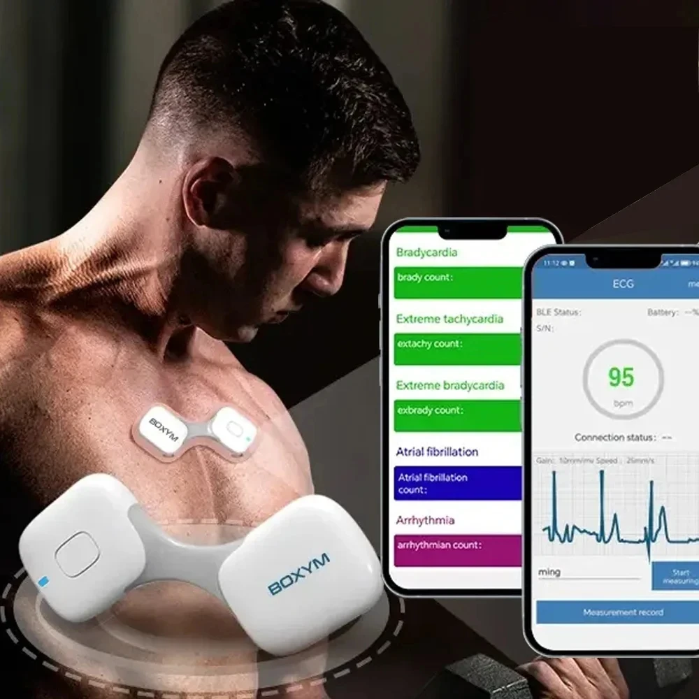 36 Hour Heart Rate ECG EKG Bluetooth Charge Holter ECG Monitor with Data Analysis Report