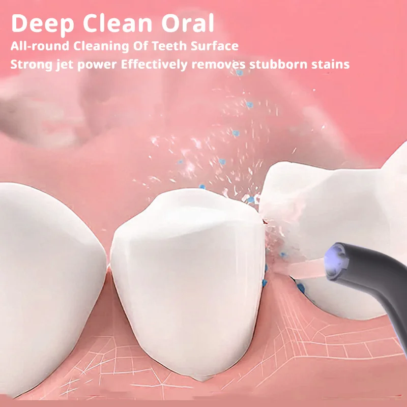 Oral Irrigator Mini Oral Irrigator Multiple Colors Portable Teeth Cleaner 2 Jet Tip 4 Modes Teeth Clean Children And Couples