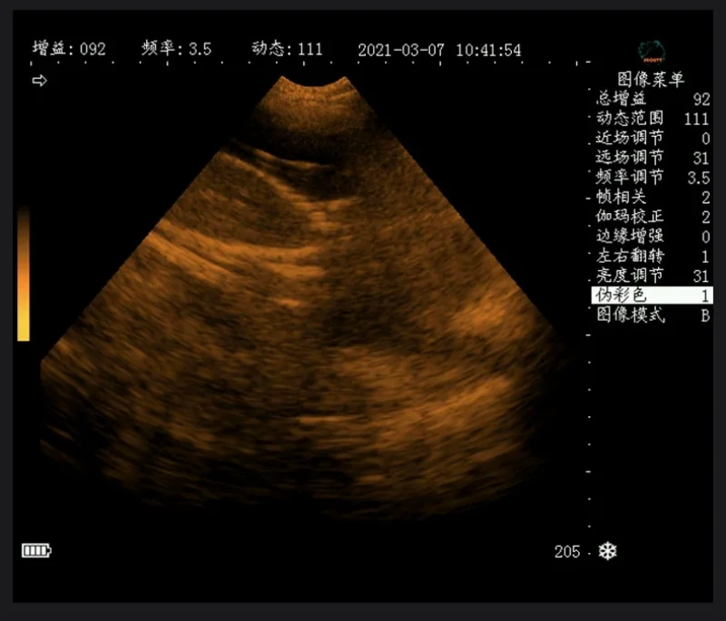 Description Picture 5 of itemVeterinary Ultrasound Scanner Portable Pregnancy Testing For Cattle Cow Pig Sheep Horse Farm Animals Pet B-ultrasound Equipment