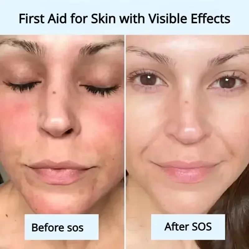 Soothing Facial Redness Repair Mask - Moisturizing & Sensitive Skin Relief Serum