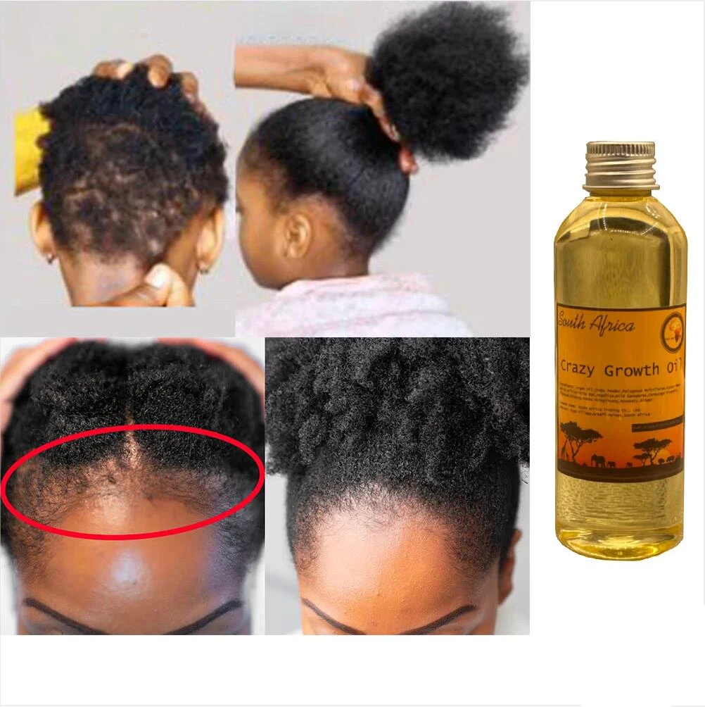 Do This If Your Hair Isn’t Growing Africa Crazy Growth Oil for Hair Growth Chebe Powder Extraction Stop Hair Shrinkage