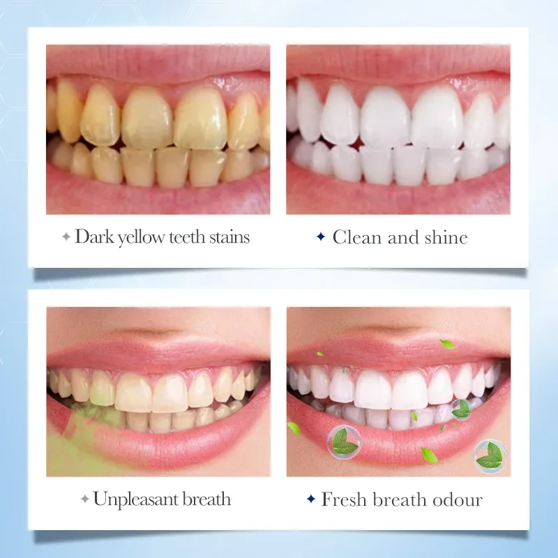 Mint Solid Toothpaste Tablets Mint Flavors Teeth Breath Mouthwash Smoke Remove Bad Whitening Fresh Charcoal Stains