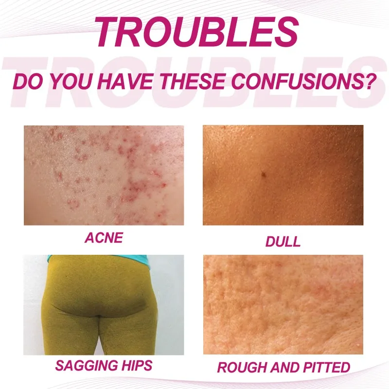 Women Body Lightening Cream Brighten Dull Fade Pimples Moisturize Lotion Butt Inner Thigh Brightening Serum Buttock Smooth Cream whitening body cream whitening cream body lotion brightening cream whitening serum brightening body cream body skin care cream