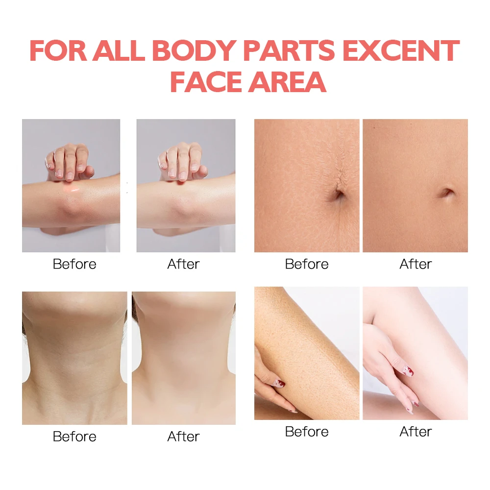 Glossy Body Serum for Wrinkles Smoothing Body Serum Hyaluronic Acid Vitamin E Glycerin Shea Butter Hydrating Nourishing Repair 3