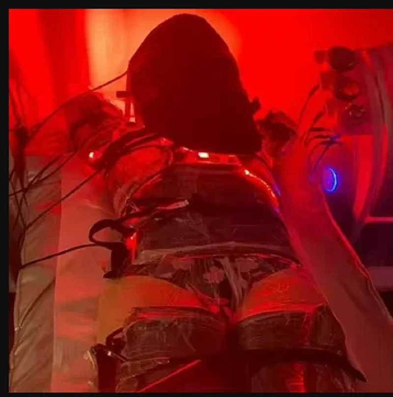 lipolysis laser