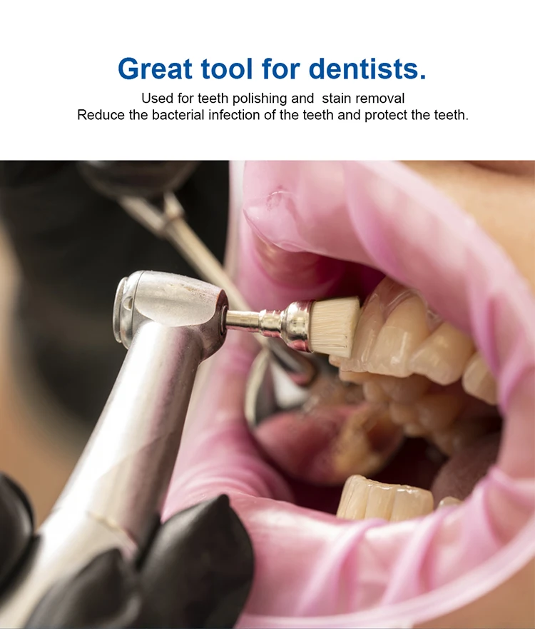 10 Stück AZDENT Dental-Polierbürsten aus Aluminiumoxid und Siliziumkarbid, Flache Scharfe Schalenform, Prophylaxe-Polierer für Winkelstücke – Detail 31