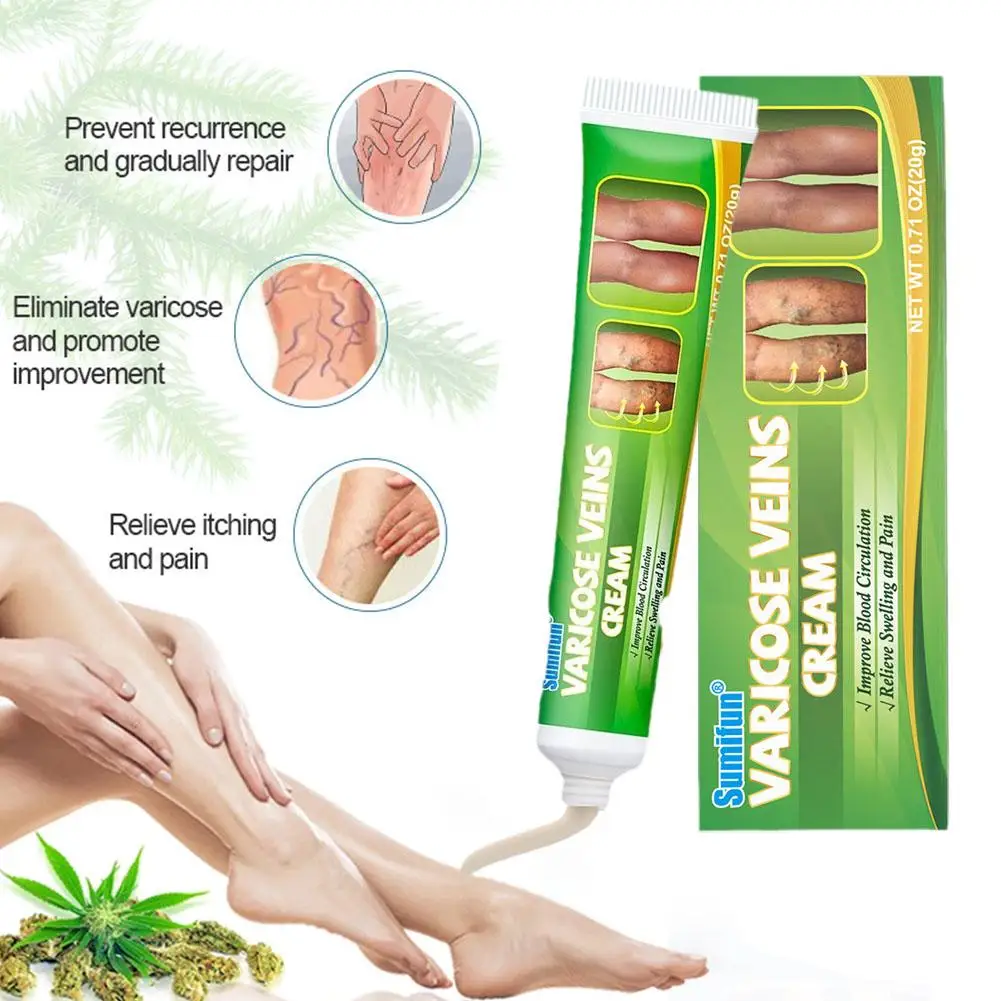 Varicose Veins Treatment Cream Relieve Legs Dilated Vasculitis Phlebitis Natural Formula Ointment varicose vein ointment