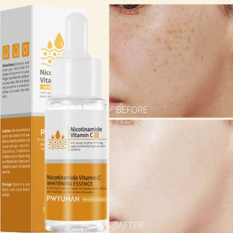 

Dark Spot Corrector Face Serum Nicotinamide Whitening Freckle Liquid Reduce Pigmentation Age Spots Brightening Skin Care Beauty