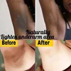 Brightening Cream For Dark Skin Effective Lighten Thigh Inner Bleach Remove Melanin Private Part Elbow Knees Brighten Skin Cream 3