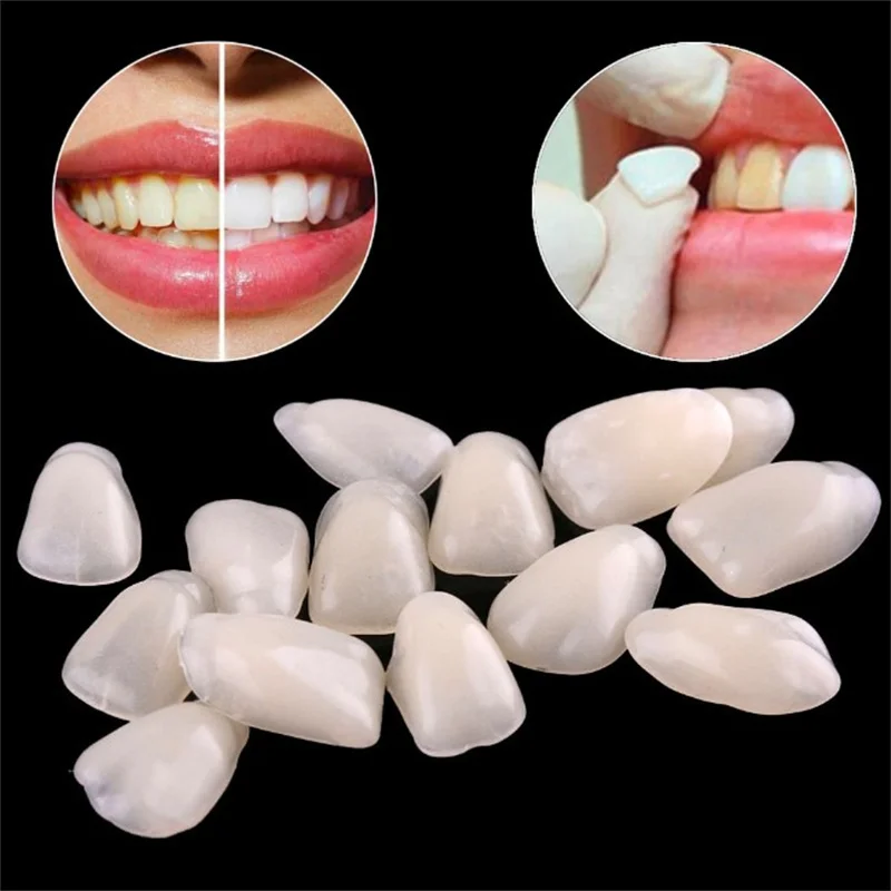 

Dental Ultra-Thin Whitening Veneers Resin Teeth Upper Anterior Shade A1 50 Pcs
