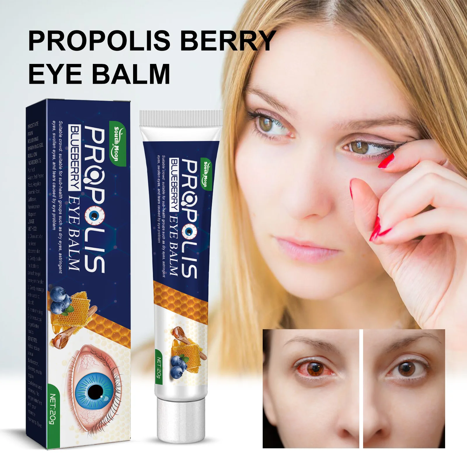 Propolis Blueberry Eye Ointment Relieves Eye Fatigue Dryness Staying Up Late And Applying Eye Care Products Around The Eyes