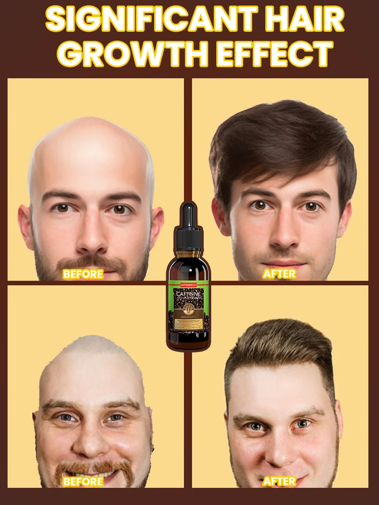 

Масло для роста волос унисекс, средство для лечения выпадения волос, быстрое средство от облысения после родов