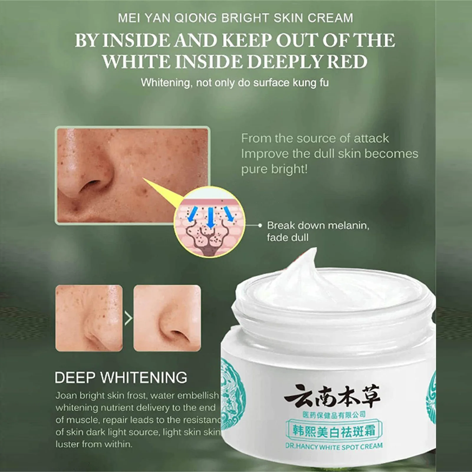 

Whitening Freckle Removal Cream Pigmentation Moisturizing Skin Care Cream for Brightens Skin Care