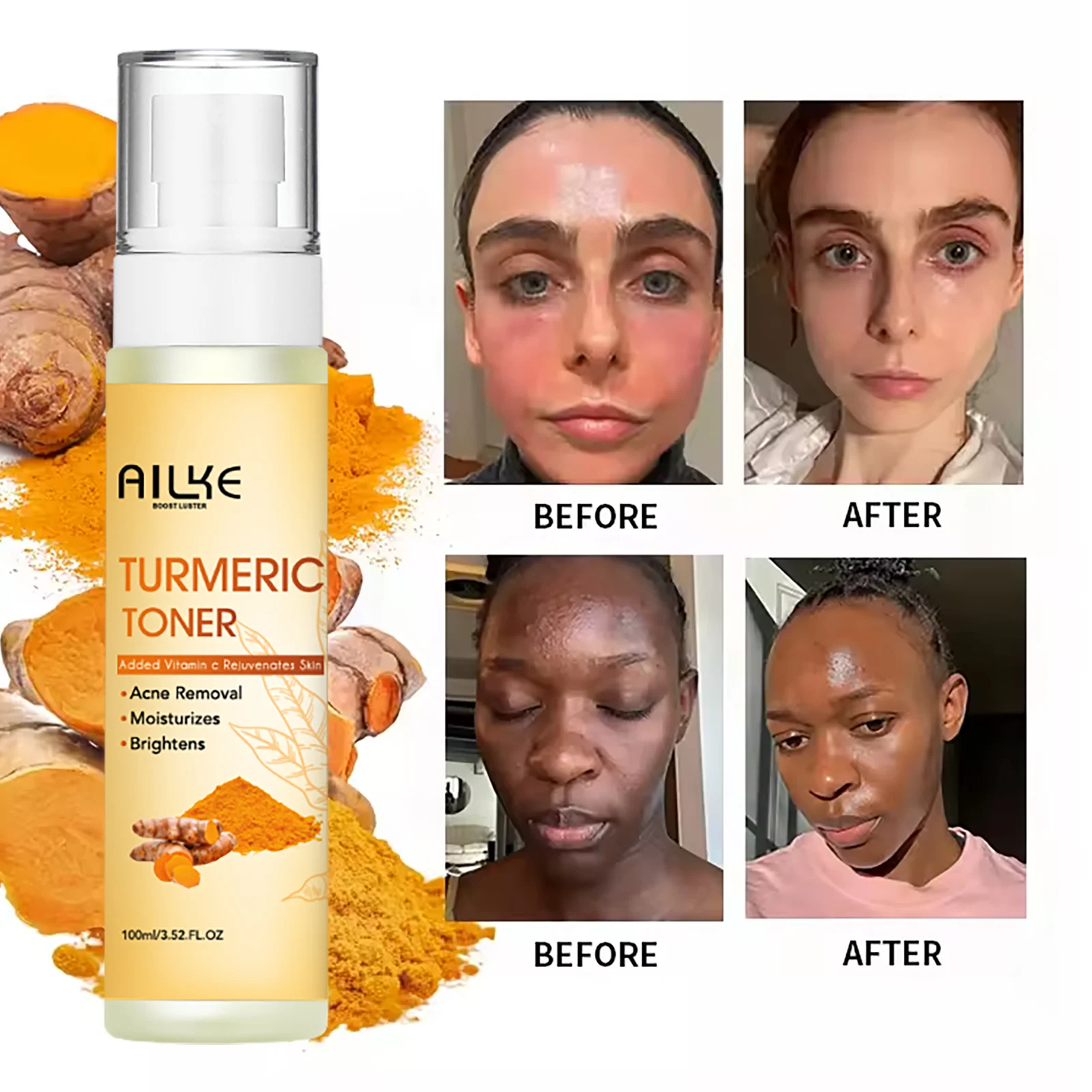 AILKE Facial Essence Toner, Reduce Spots,Pimples ,Glowing Skin, Hydrating, Purifying, Cruelty Free, Vegan 6