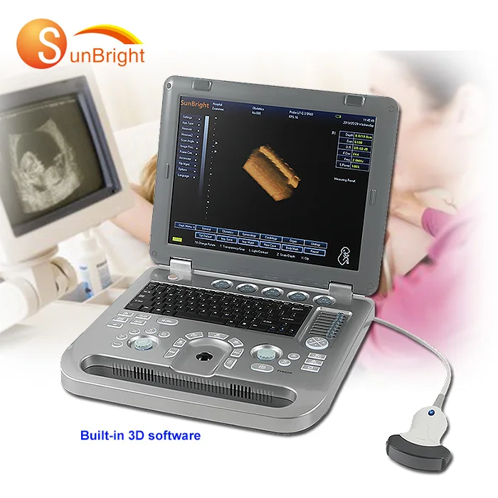 

New veterinary use 3d mobile ultrasound