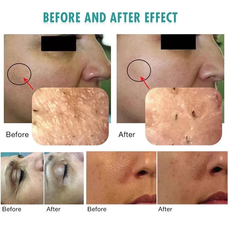 3 In 1 Ultrasound Oxygen Bubble Facial Lifting Skin Care Whitening CO2 Oxygention Therapy Skin Rejuvenation Moisturizing Machine 6