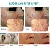 3 In 1 Ultrasound Oxygen Bubble Facial Lifting Skin Care Whitening CO2 Oxygention Therapy Skin Rejuvenation Moisturizing Machine 6