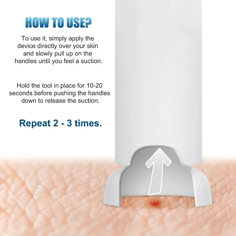 Insect Sting Sucker Outdoor Emergency Bee Wasp Bed Bug Sting Sucker Natural Detox First Aid Safety Tool