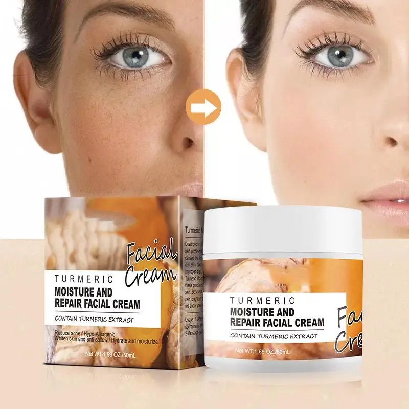 

Turmeric Facial Skin Repair Cream Acne Treatment Face Moisturizer Whitening Lightening Against Acne Remover Cream