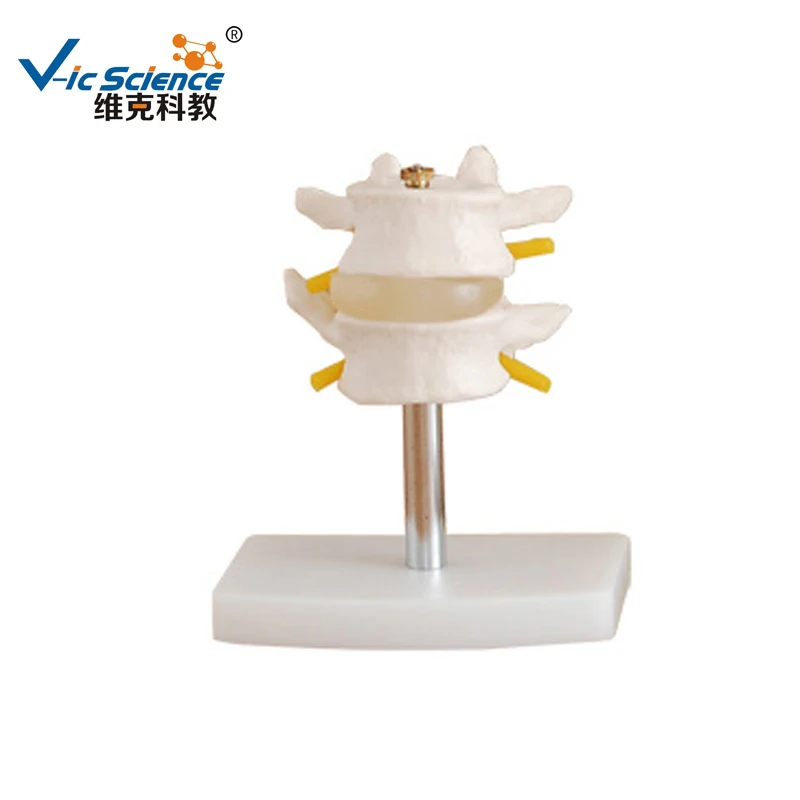 

Набор для поясницы (2 шт.), анатомическая модель человеческого позвоночника