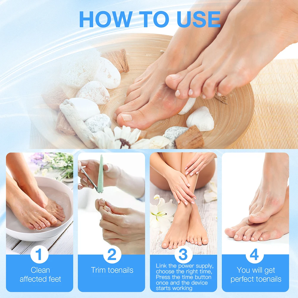Nail Laser Fungus Device 680NM Red light Killing Fungi + 470nm Blue Light Antiphsis All-inclusive Nail Fungus Treatment 20W nail fungus remover