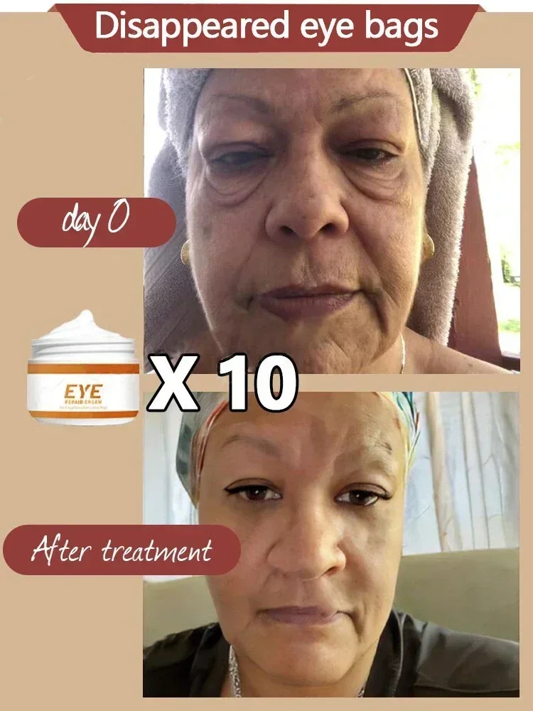 Anti-Wrinkle Eye cream Remove bags Puffiness Dark Circles under eyes Lightening Fine Lines Moisturizing Whitening Skin Care - Image 3