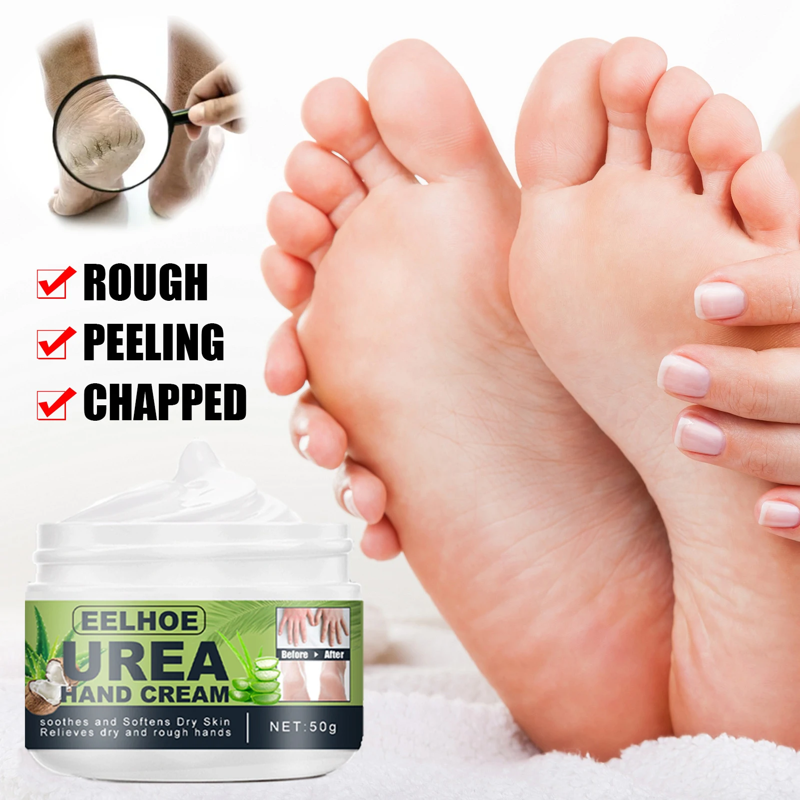 Anti Fungal Foot Repair Foot Cream Dead Skin Removal Peeling