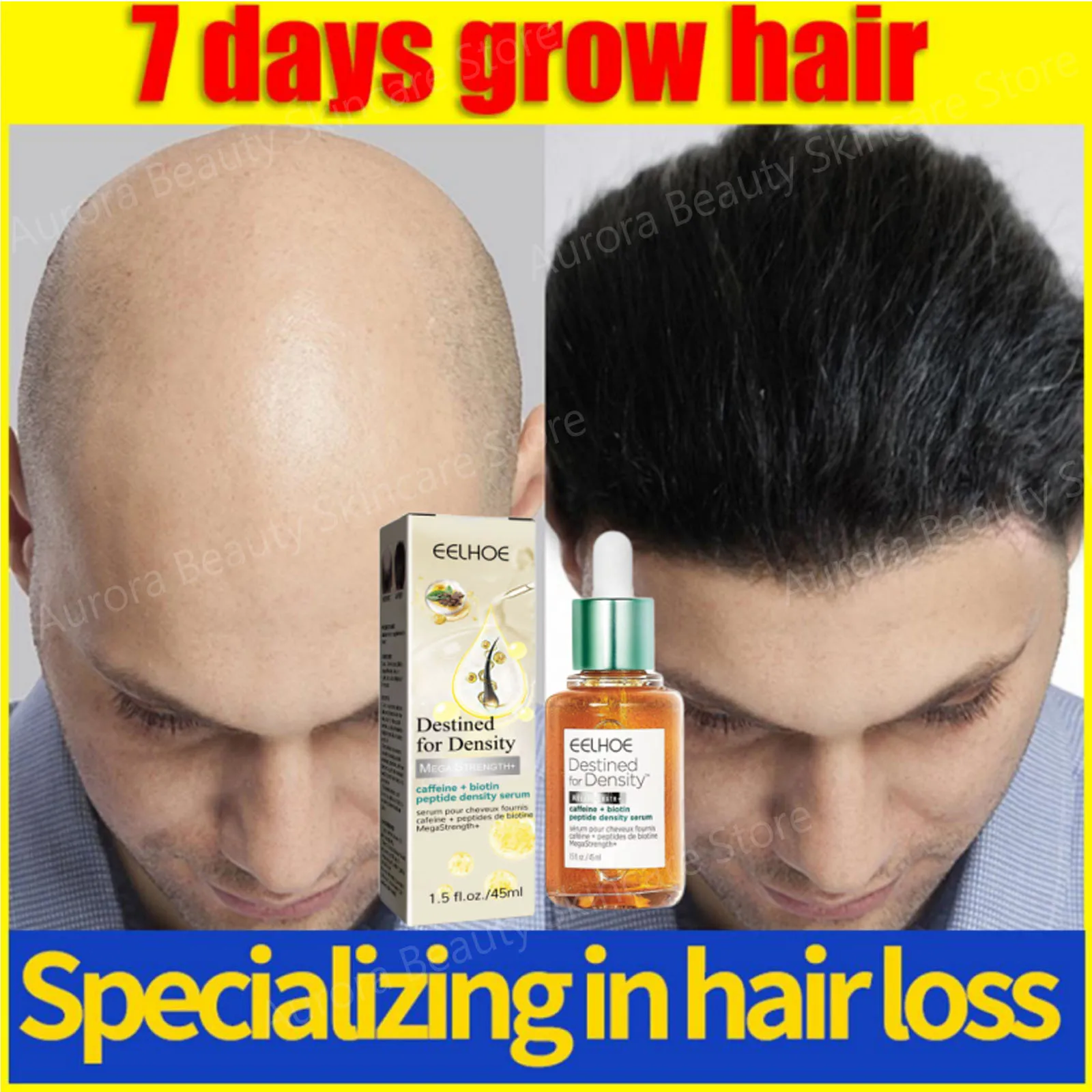 

Fast Hair Growth Hair Oil Follicle Treatment Seborrheic Alopecia Hairline Upward Postpartum Hair Loss Prevent Baldness Products