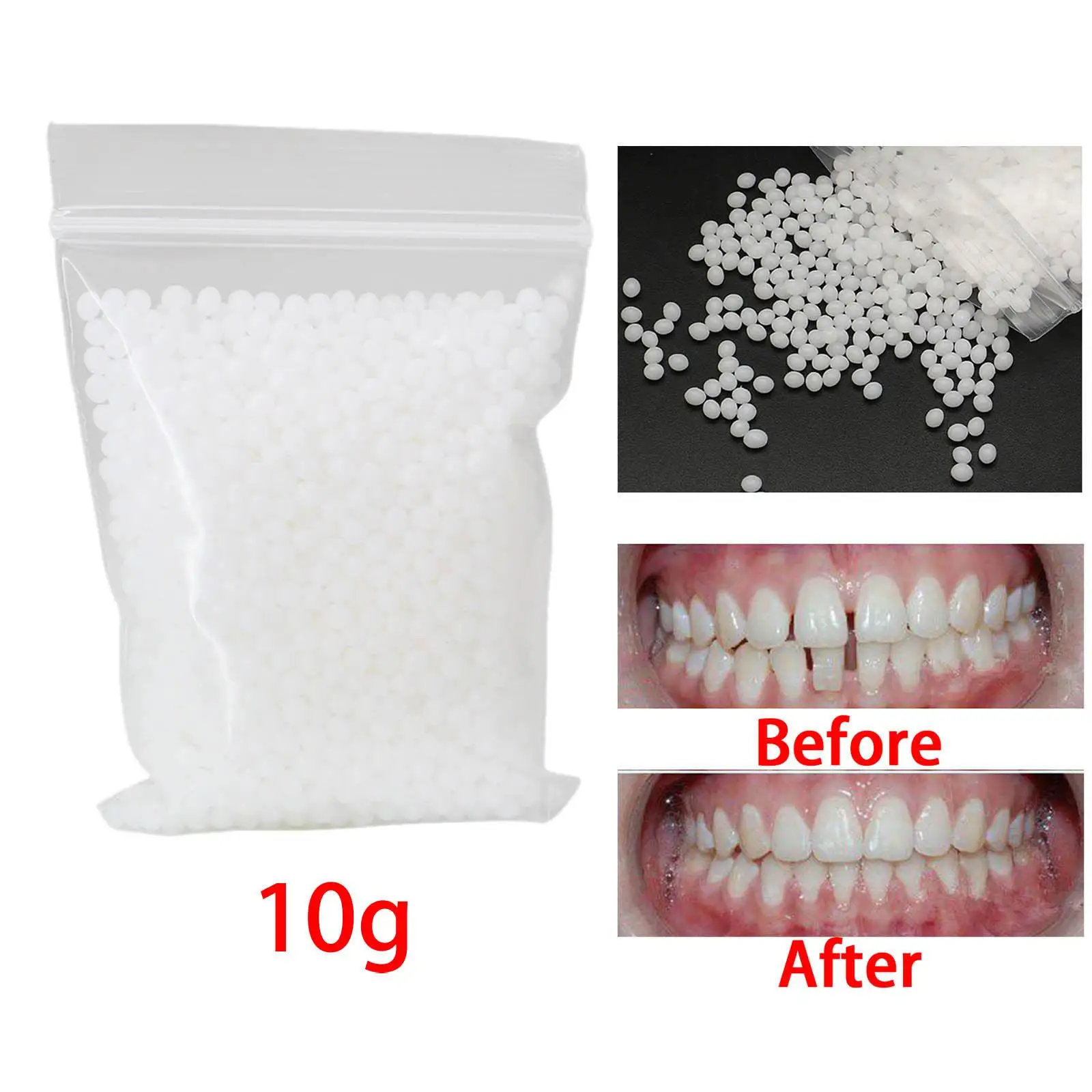 50g/100g Temporary Tooth Repair kit for Fix Filling the Missing Broken  Tooth and Gaps, Moldable Fake Teeth Veneers and Thermal Beads Replacement  Kit, Artificial Teeth 