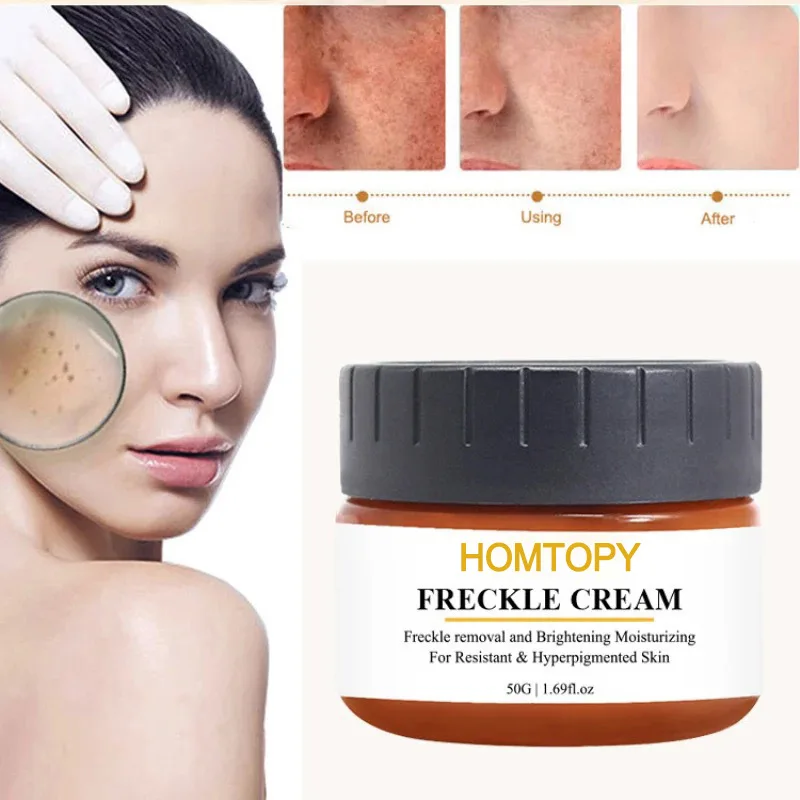

Dark Spot Remover for Face, Hyperpigmentation Treatment, Melasma, Freckle, Sun Spots Removal for All Skin Types Dark Spot Correc