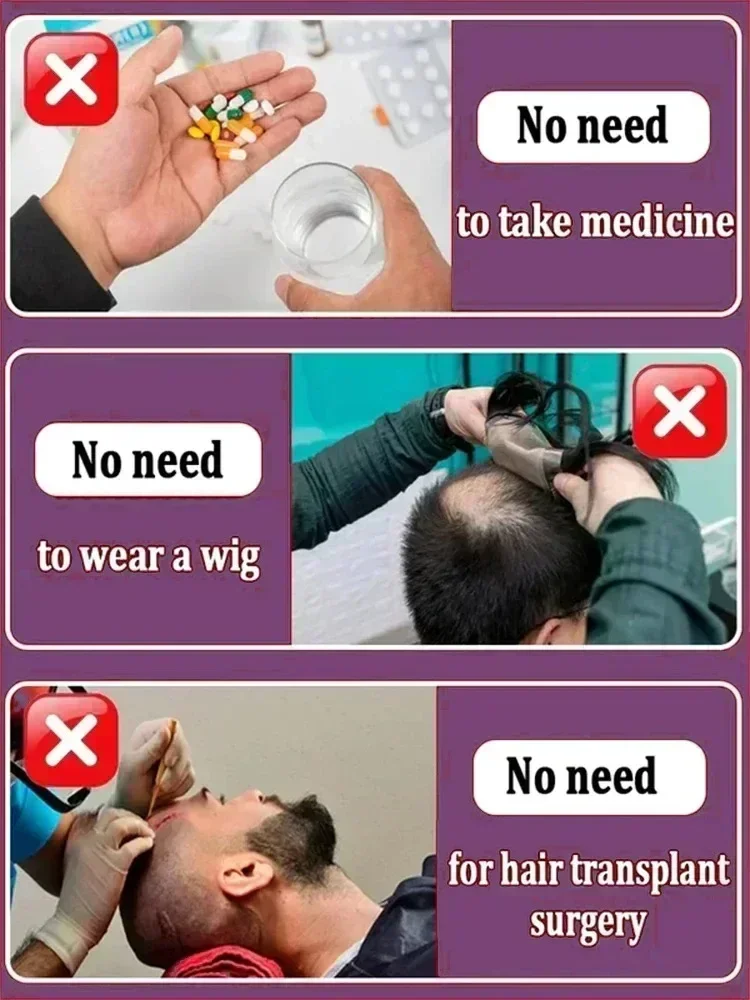 Hot selling product, 99% of buyers buy again, have more and more hair, say goodbye to baldness, thick hair
