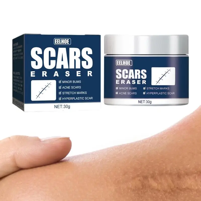 

Scar Fade Cream Stretch Marks Removal Pimple Scars Skin Repair Whitening Moisturizing Cream Dark Spot Ointment Face Skin Care