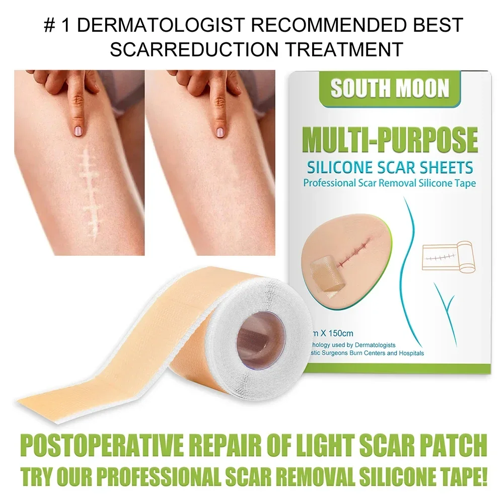 150cm Medical Treatment Sheet Tape Silicone Scar Skin Repair for Multi-purpose