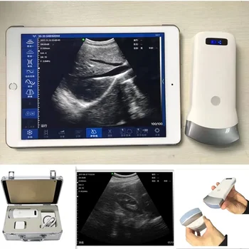 Sonda convessa per scanner con sonda ad ultrasuoni wireless 80E 3,2/5.0 MHz Supporto IOS Android Windows