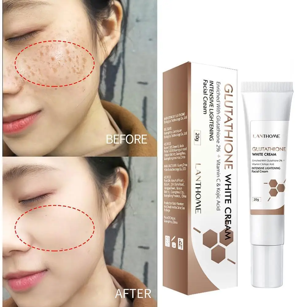 

Glutathione Skin Whitening Cream Freckles Removal Spots Spot Dark Skin Moisturizing Lighten Care Cream Remo A7C2