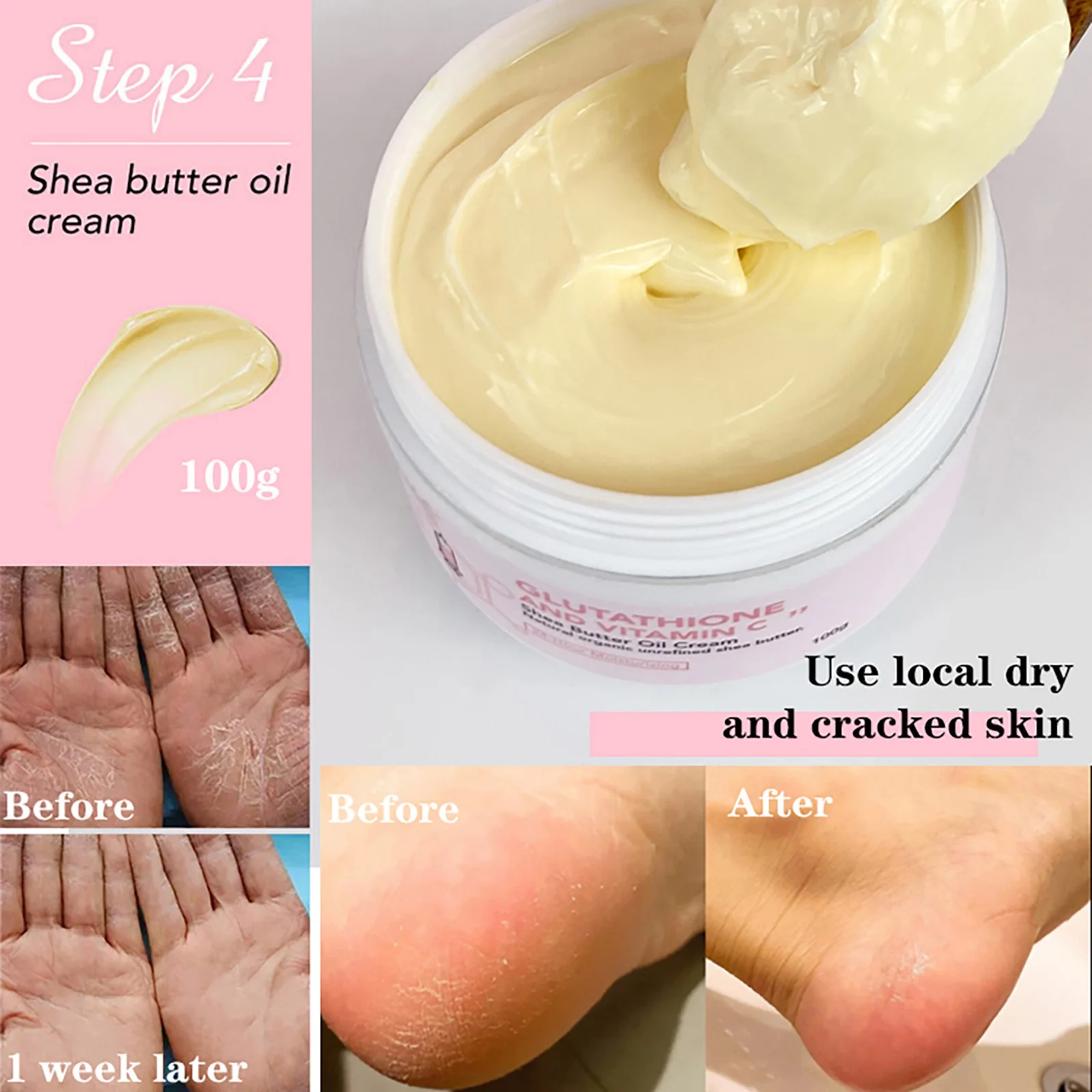 AILKE Vitamin C Lotion. Advanced Brightening Cream. Whiten Serum Remove Melanin, Age Spots, Dark Spots On Face, Hands, Body. 4