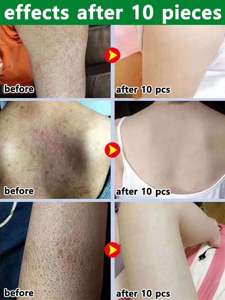 Body lotion solves strawberry legs and clears acne