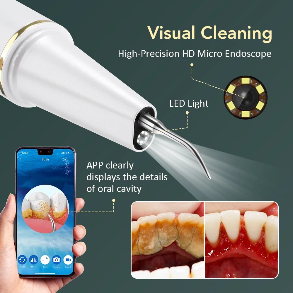 Visual Electric Ultrasonic Dental Scaler 3 Modes Calculus Oral Tartar Remover Tooth Stain Cleaner Teeth Whitening Oral Care