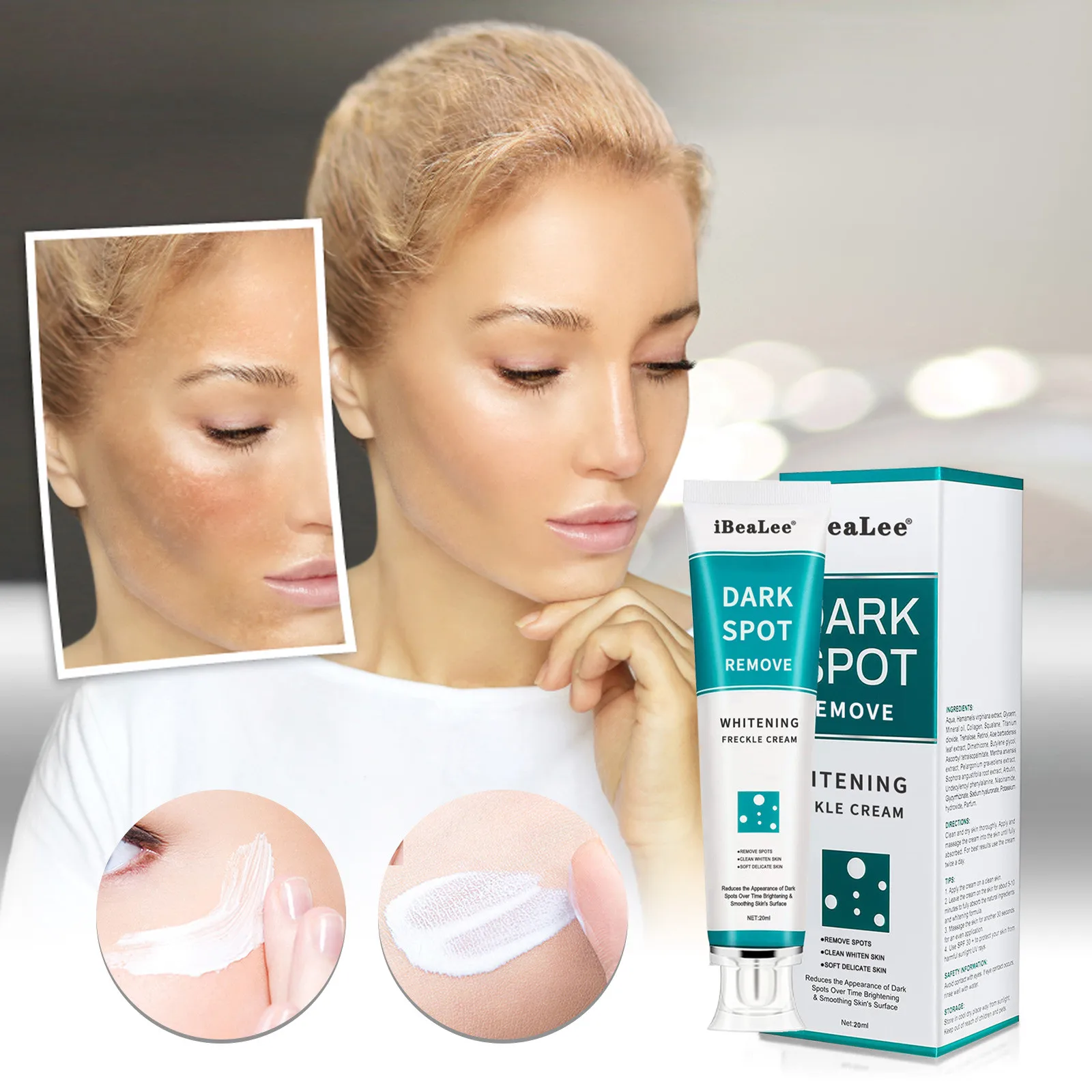 Whitening Freckle Cream Remove Dark Spots Melanin Melasma Remover Brightening Skin Effective Repair Anti-Aging Skin Care