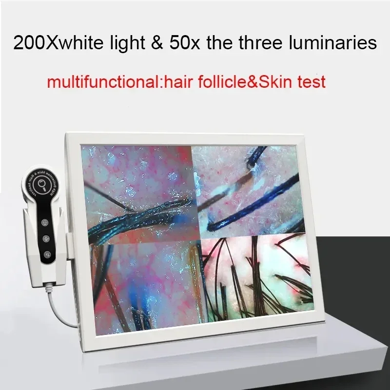 Analizzatore digitale HD della pelle Rilevatore professionale della fotocamera del cuoio capelluto dei capelli Dispositivo per test dell'umidità dell'olio dei follicoli piliferi 15 pollici